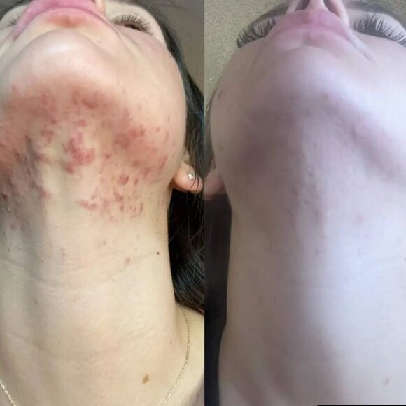 Skincerity - Picture 4 of 6